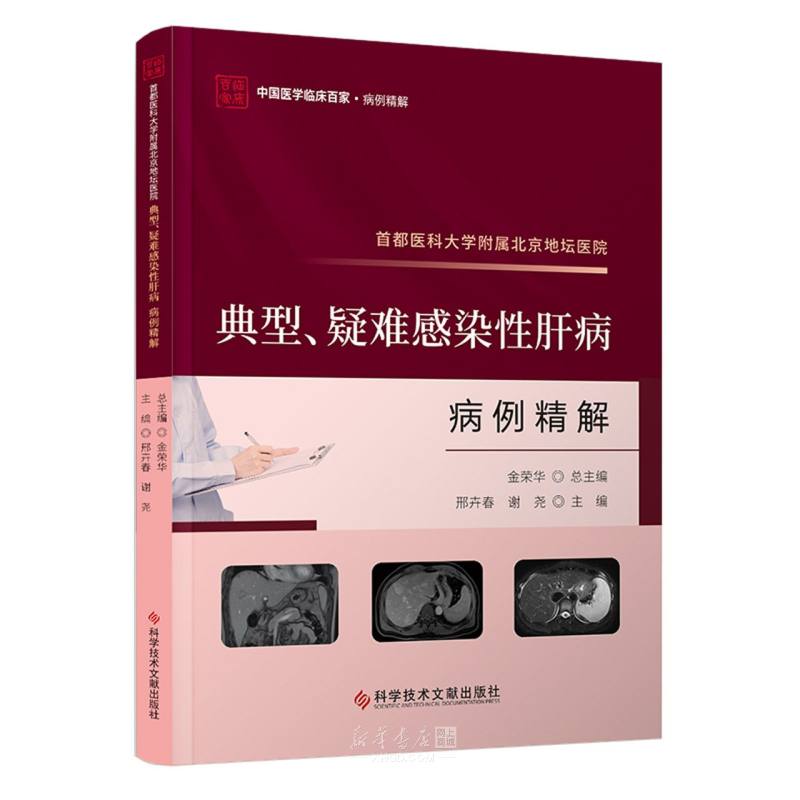 《首都医科大学附属北京地坛医院典型疑难感染性肝病病例精解/中国医学临床百家》